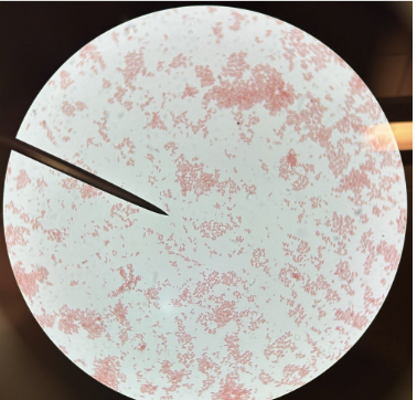 <p>gram negative rods/coccobacilli (much more short-looking):</p>