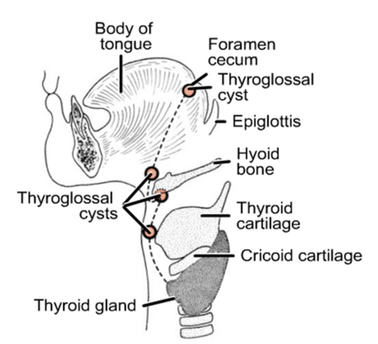 <p>Thyroglossal duct.</p>