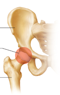 <p>Which joint is this an example of? </p>