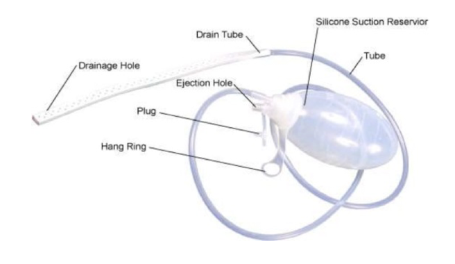 <p><span style="color: blue"><strong>closed, active </strong></span><strong>surgical drain: </strong>connects to negative pressure device<br>-often used to drain wound/incision</p>
