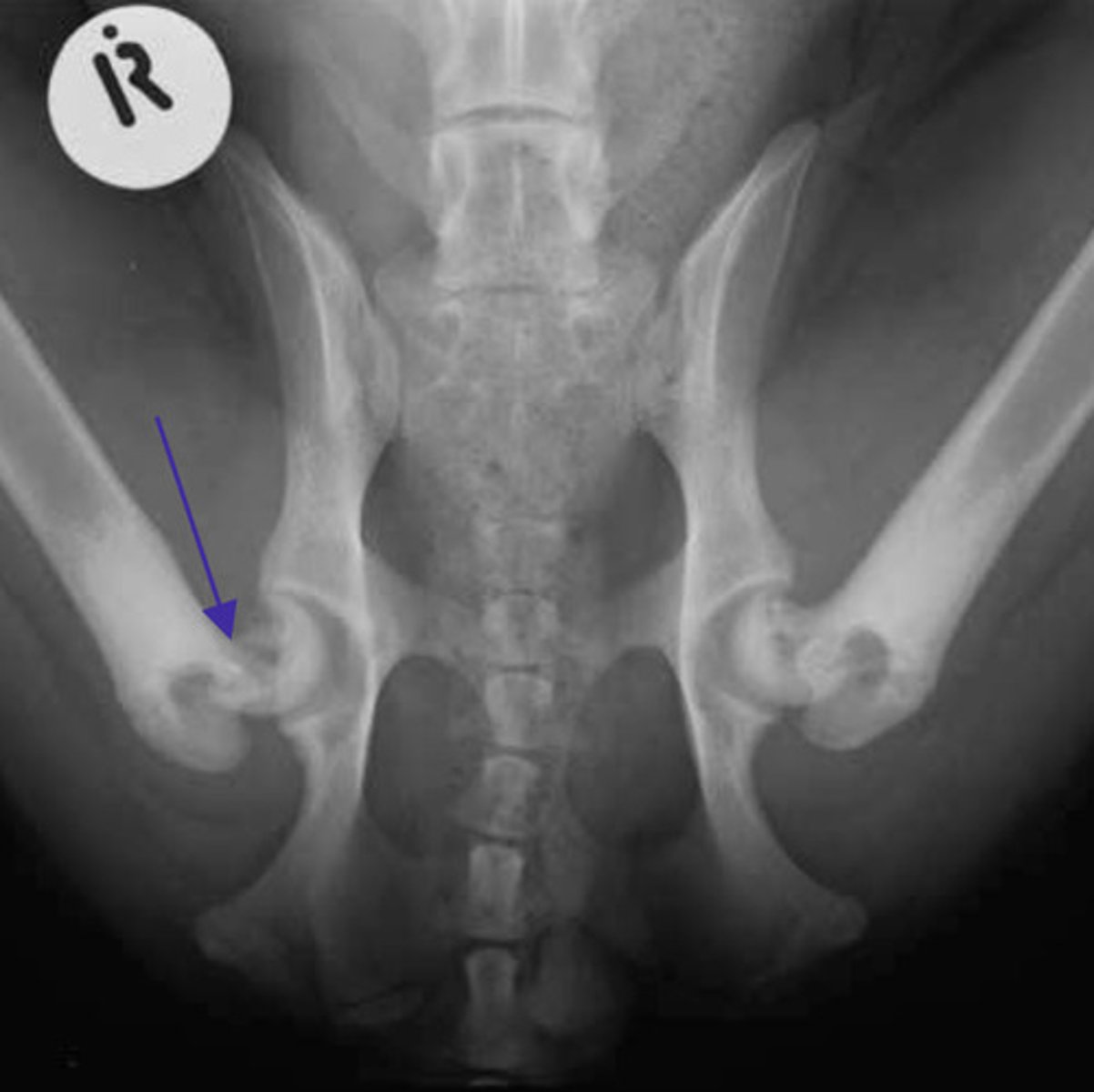 <p>What is wrong in this radiograph?</p>