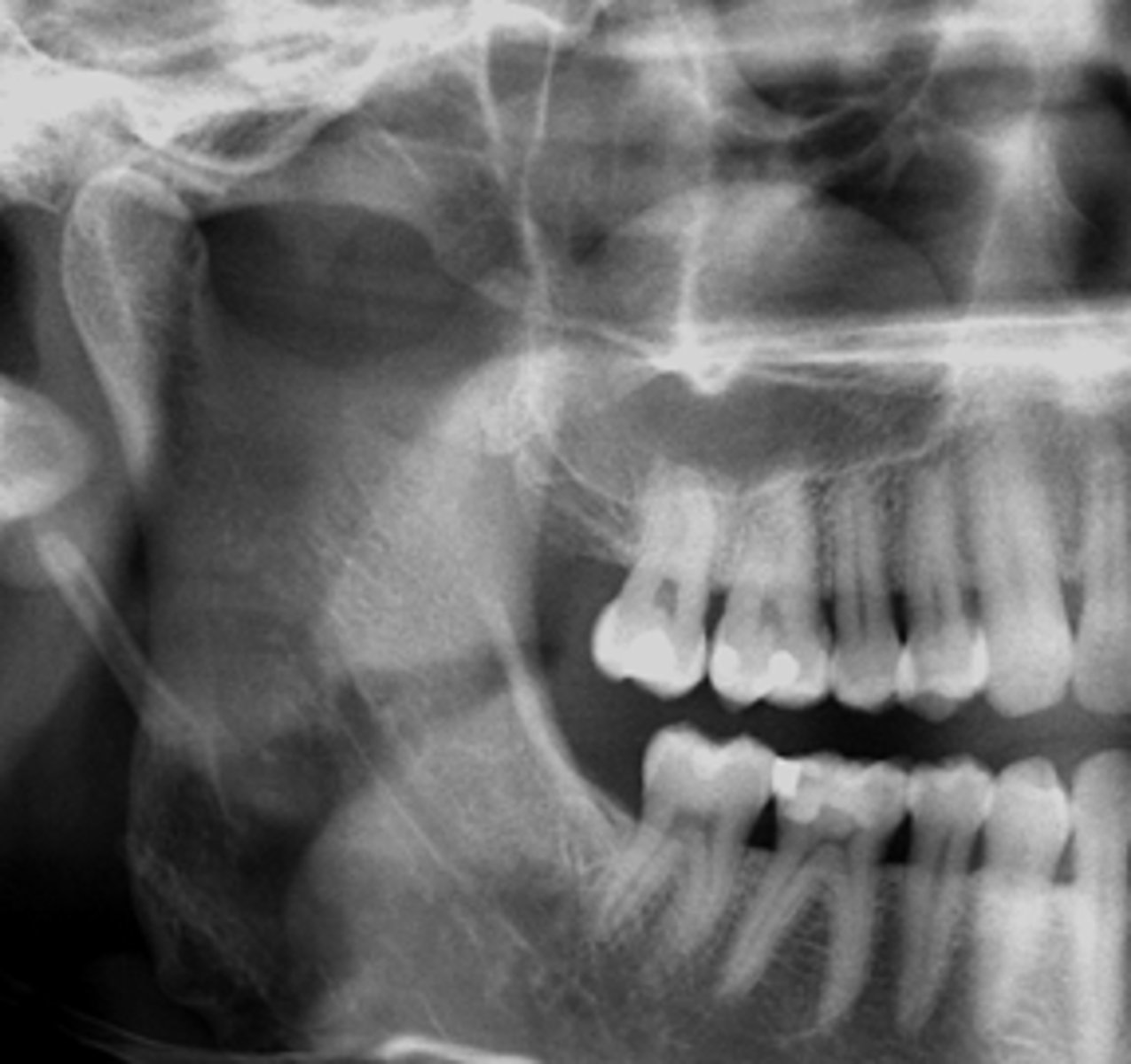 <p>ID the cyst:</p>