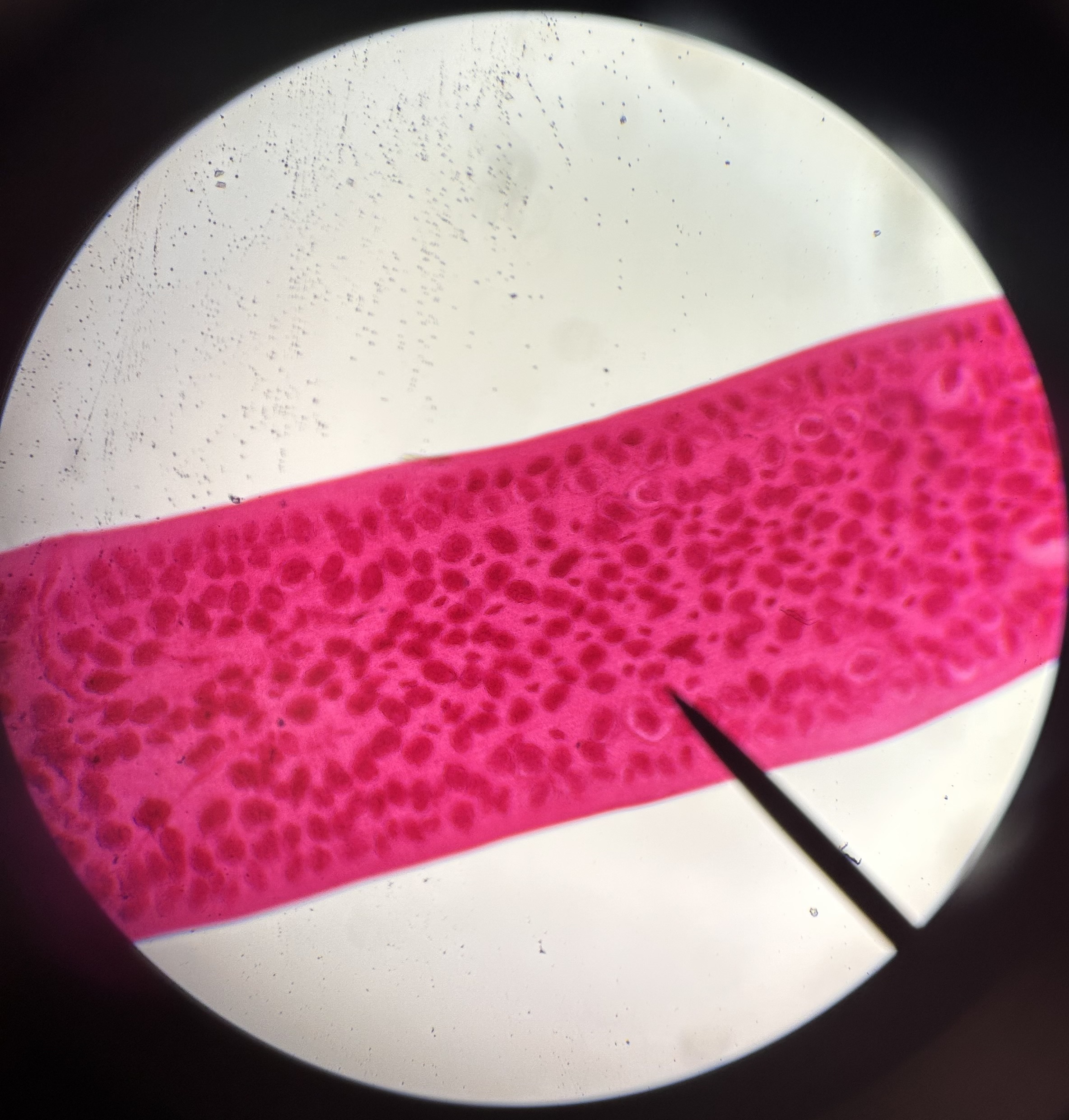 <p>Identify the organism and the Class it belongs to</p>