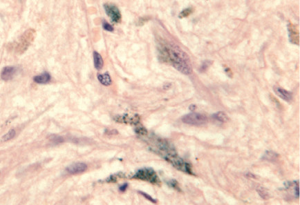<p>Identify endocrine organ, tissue type and type of cells</p>