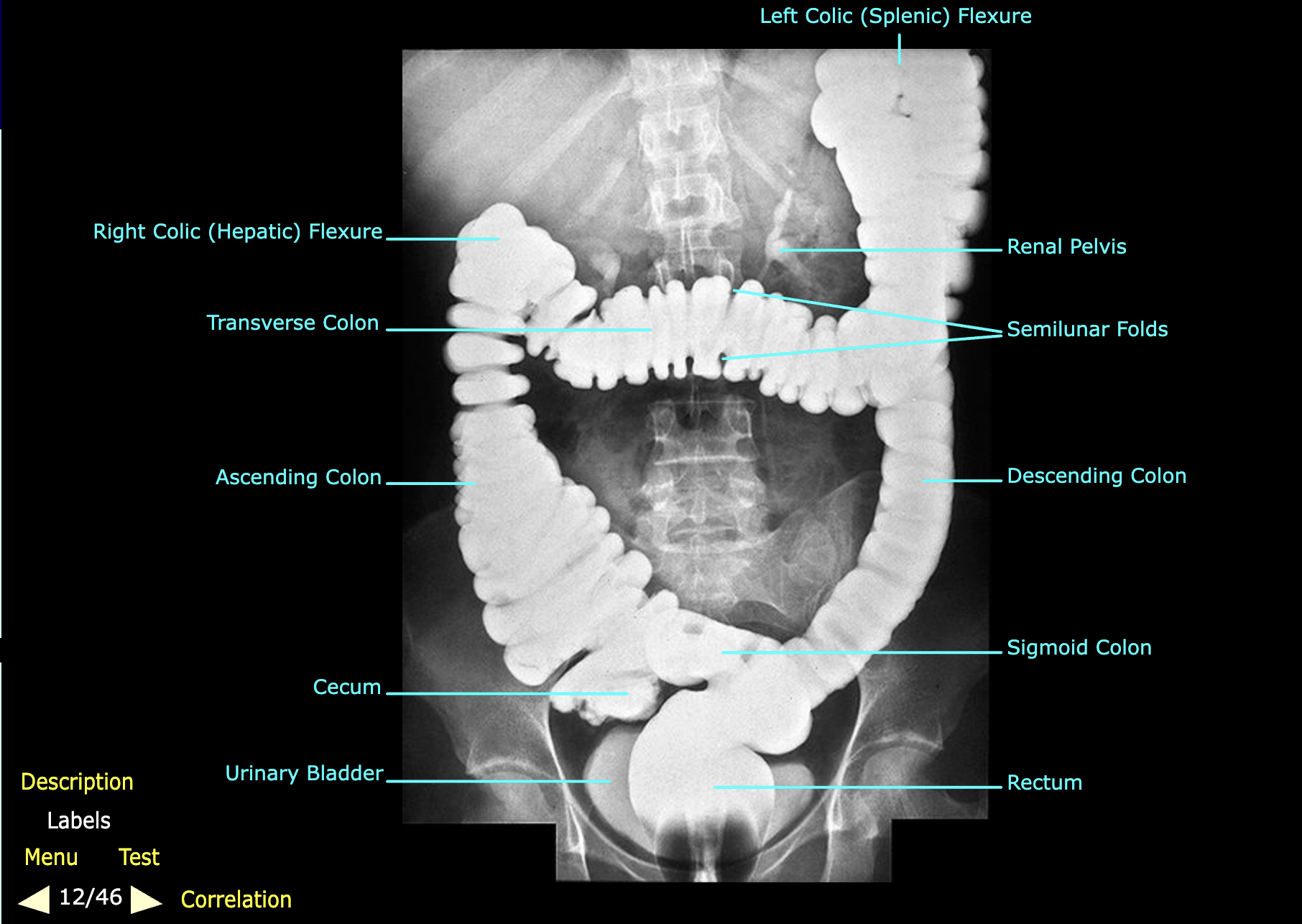 knowt flashcard image