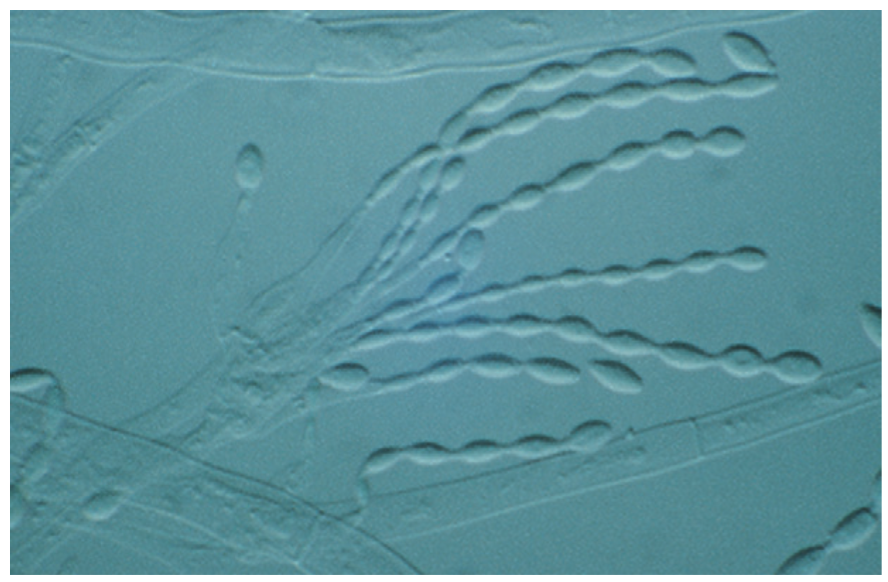 <p>A genus of filamentous fungi found in soil and decaying organic matter.</p>