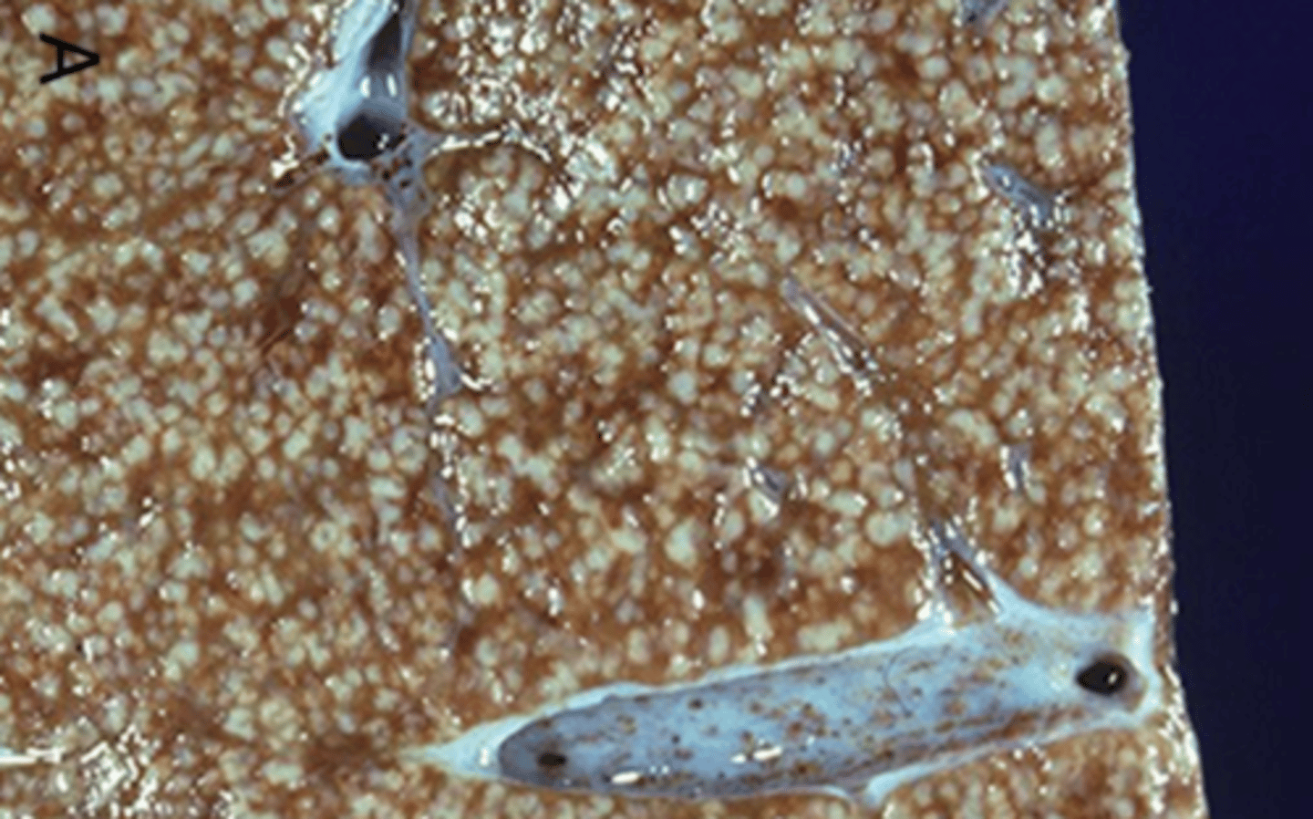 <p>hígado.</p><p>¿diagnóstico y etiología?</p>