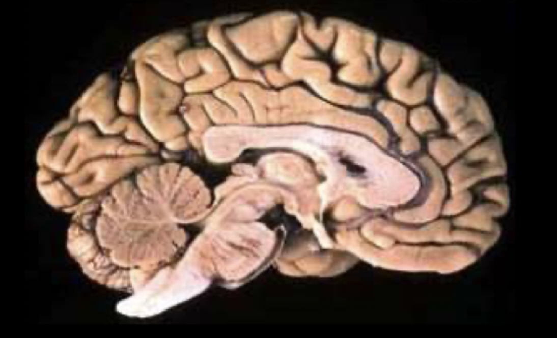 <p>What view of the brain is this?</p>