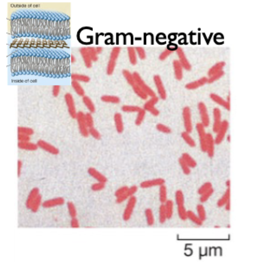 <p>have a thinner peptidoglycan cell wall in between two lipid bilayers; stains <em>red</em></p><p>outer membrane made of LPS not phospholipids</p><p>periplasm (area between cell wall and membranes) is where activity occurs</p>