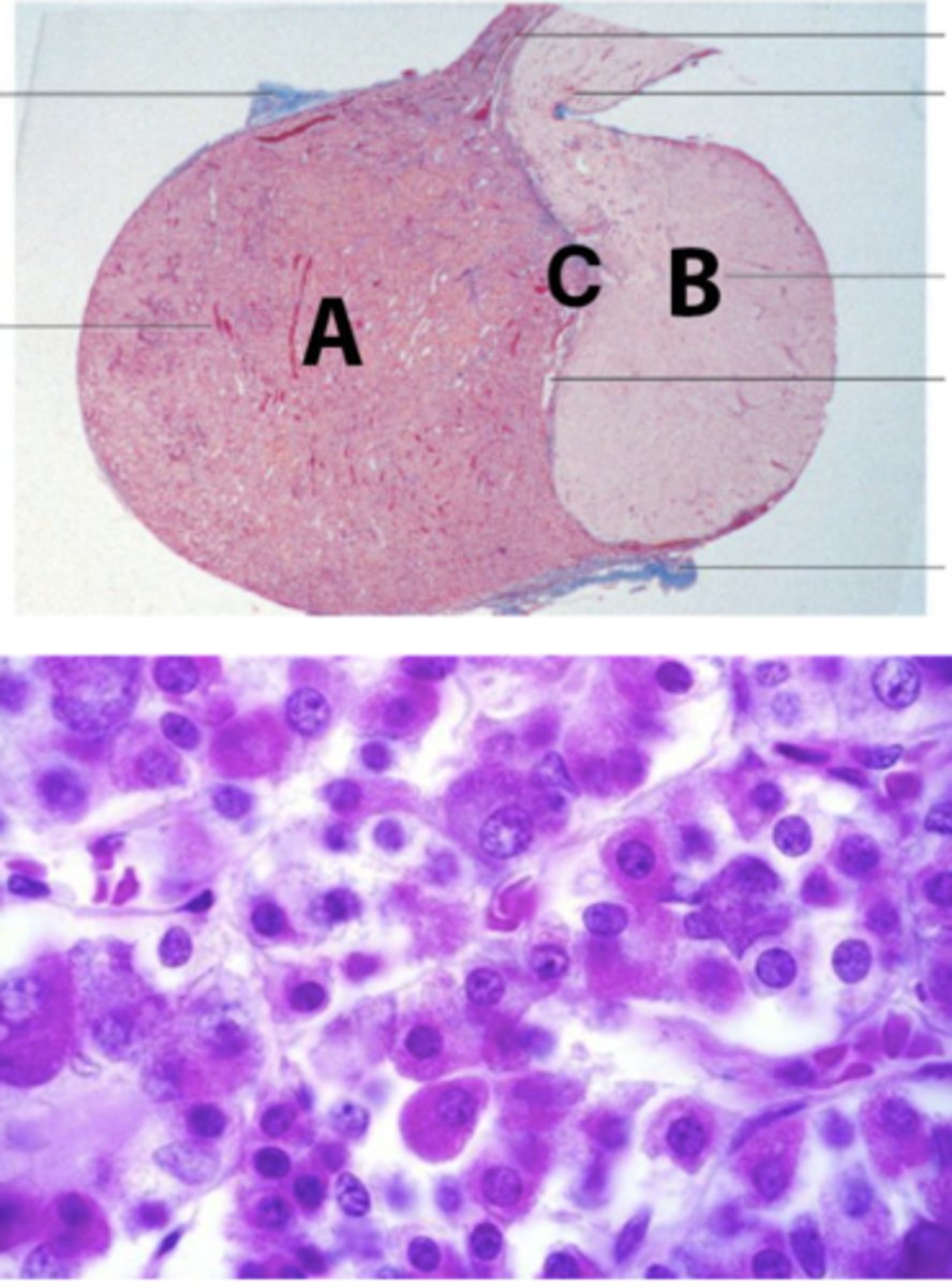 <p>What is the prohormone synthesized by pars intermedia, shown as C in the picture?</p>