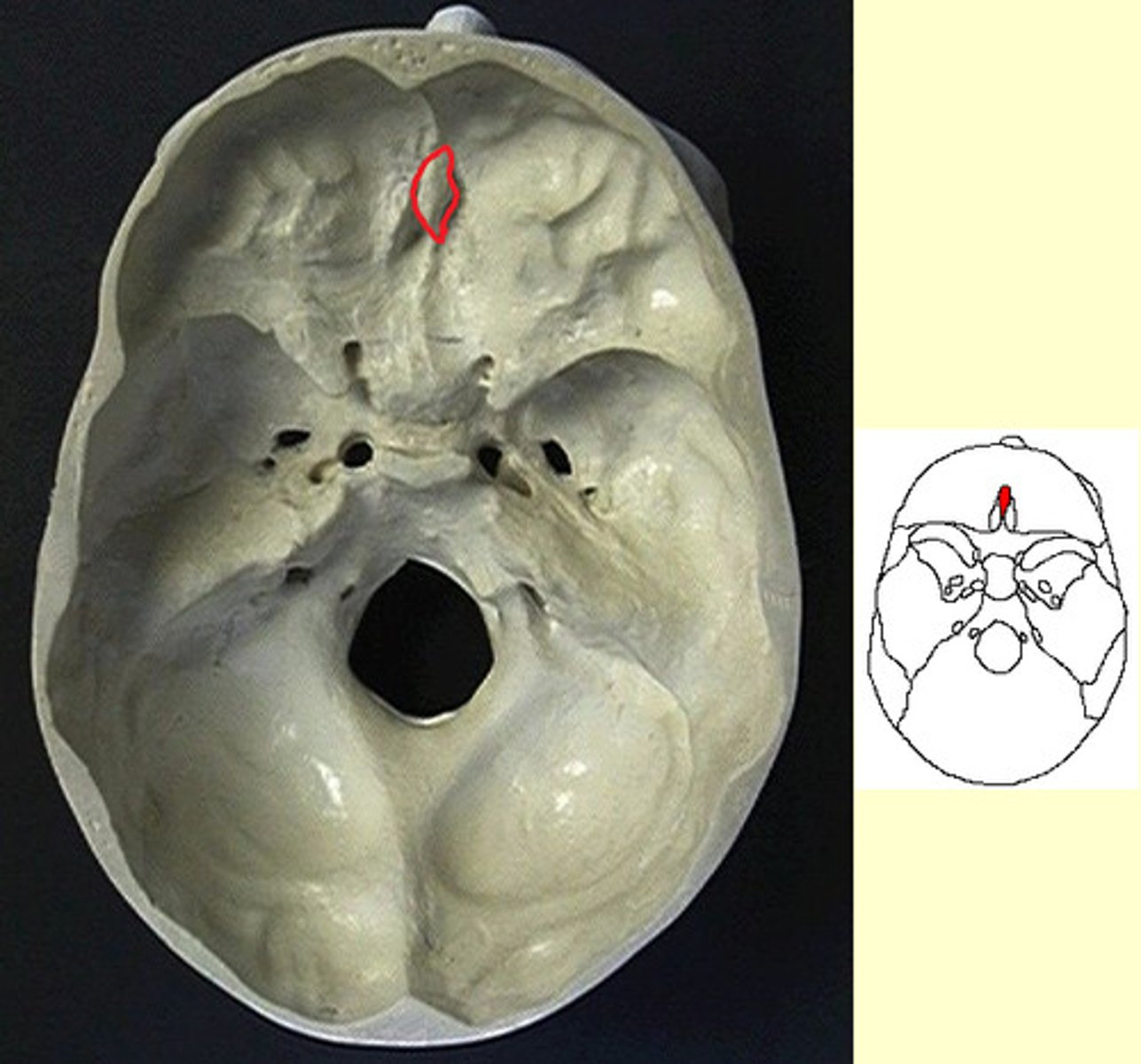 knowt flashcard image