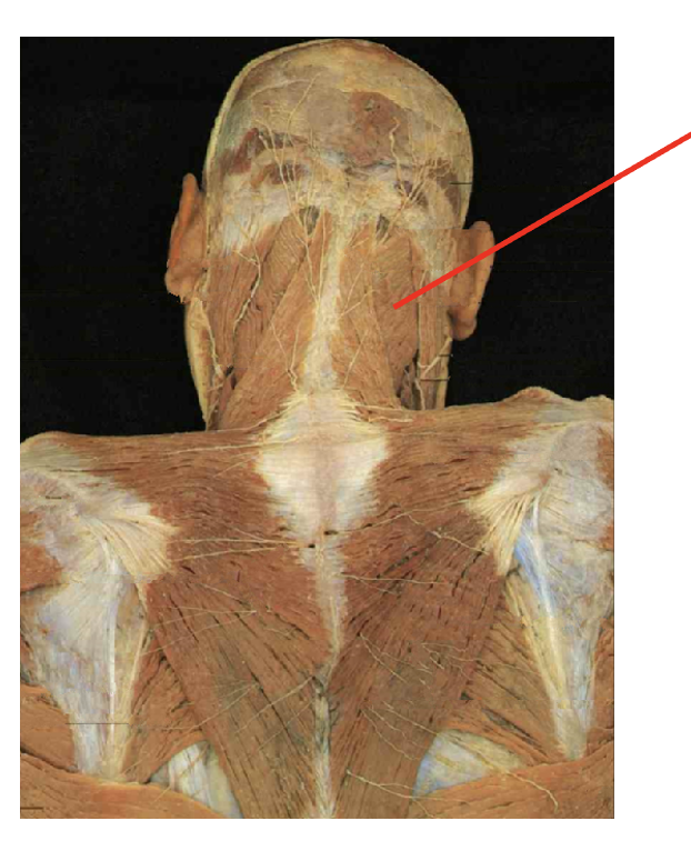 <p>What is this muscle: What is its origin. Where does it inserts.</p>