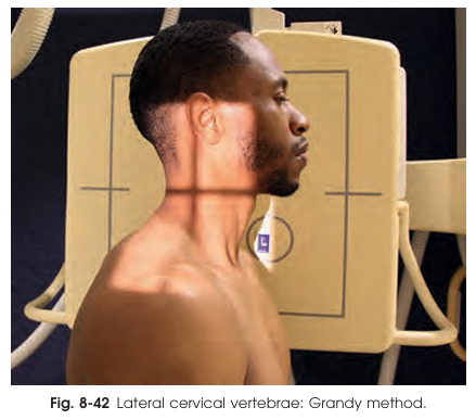 <p>IR position for the lateral cervical spine projection Grandy Method</p>