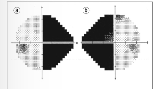 <p>What is this VF plot showing</p>