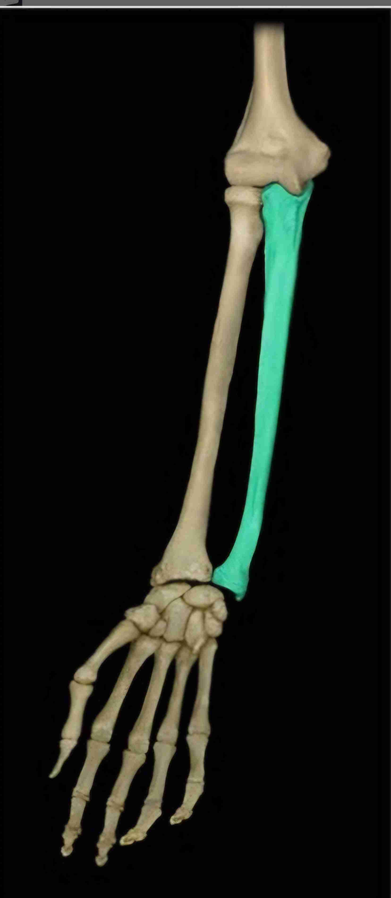 <p>What bone is this?</p>
