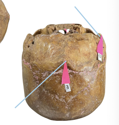 <p>Identify the structure of the skull labelled as D.</p>
