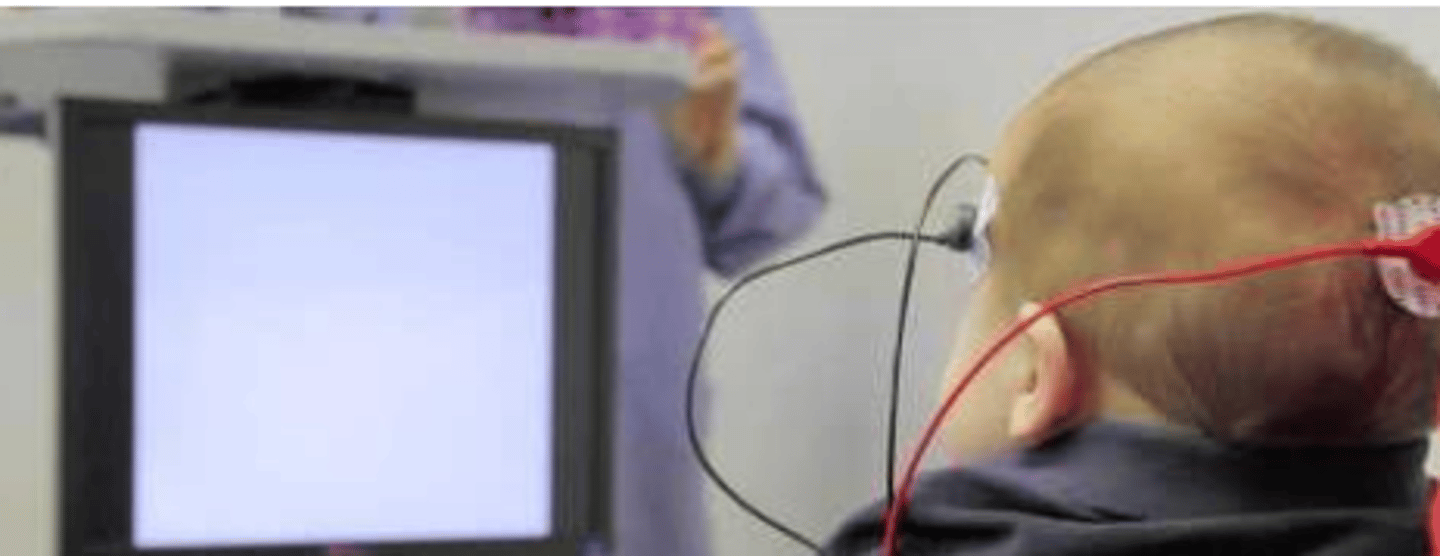 <p>_____ may be indicated by a loss of binocular summation over a wide range of stimulus conditions. It is important to detect this early in life in order to encourage proper binocular vision development. In infants, ______ can be used to evaluate their binocular summation capabilities.</p>