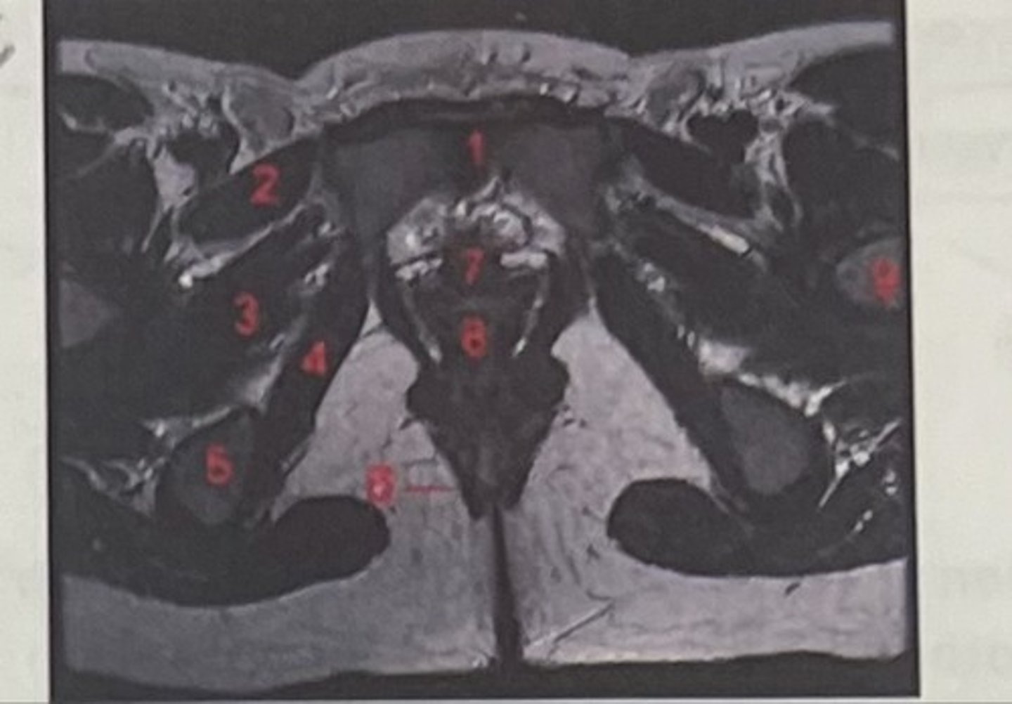 <p>What is 4</p>