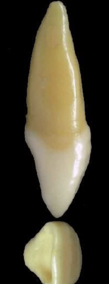 <p>what tooth is this &amp; why?</p>