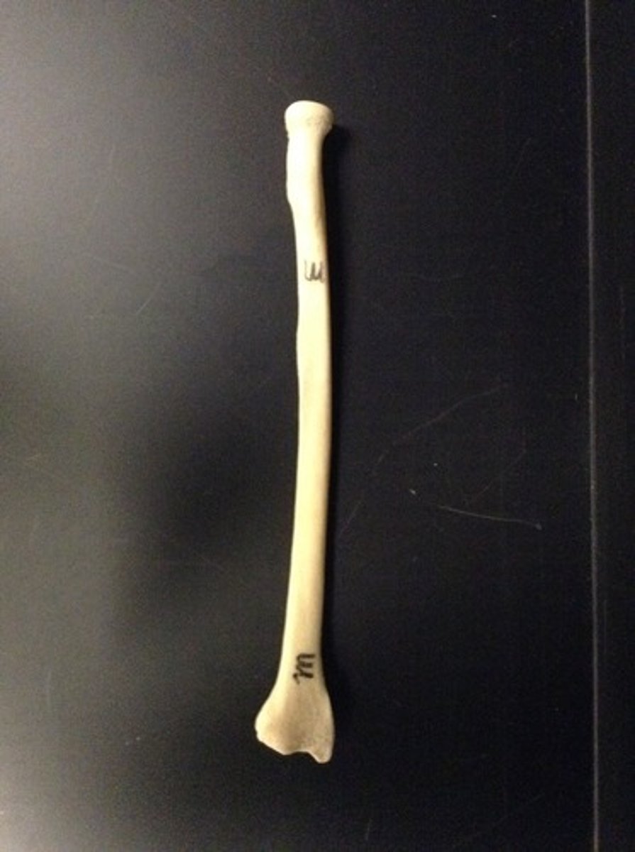 <p>ID bone</p>