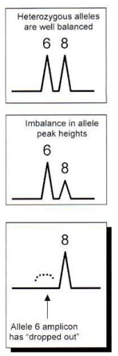 <ul><li><p>6 is not detected</p></li><li><p>At 3’ end, it can’t anneal properly</p></li><li><p>It won’t be amplified</p></li><li><p>Only the other allele is amplified</p></li></ul><p></p>