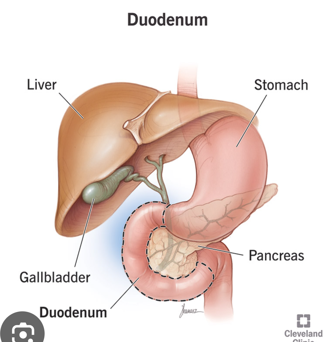 <ol start="2"><li><p>Epigastric Region </p></li></ol><p></p>