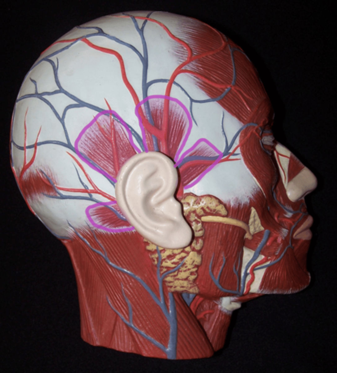 <p>Windmill-like, by ear, above temporalis</p>
