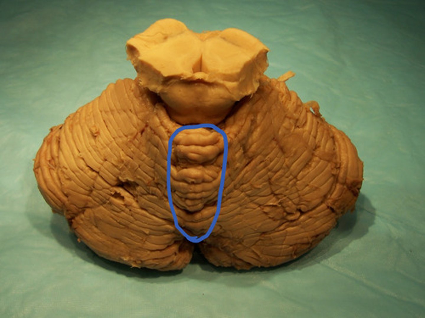 <p>identify the structure</p>