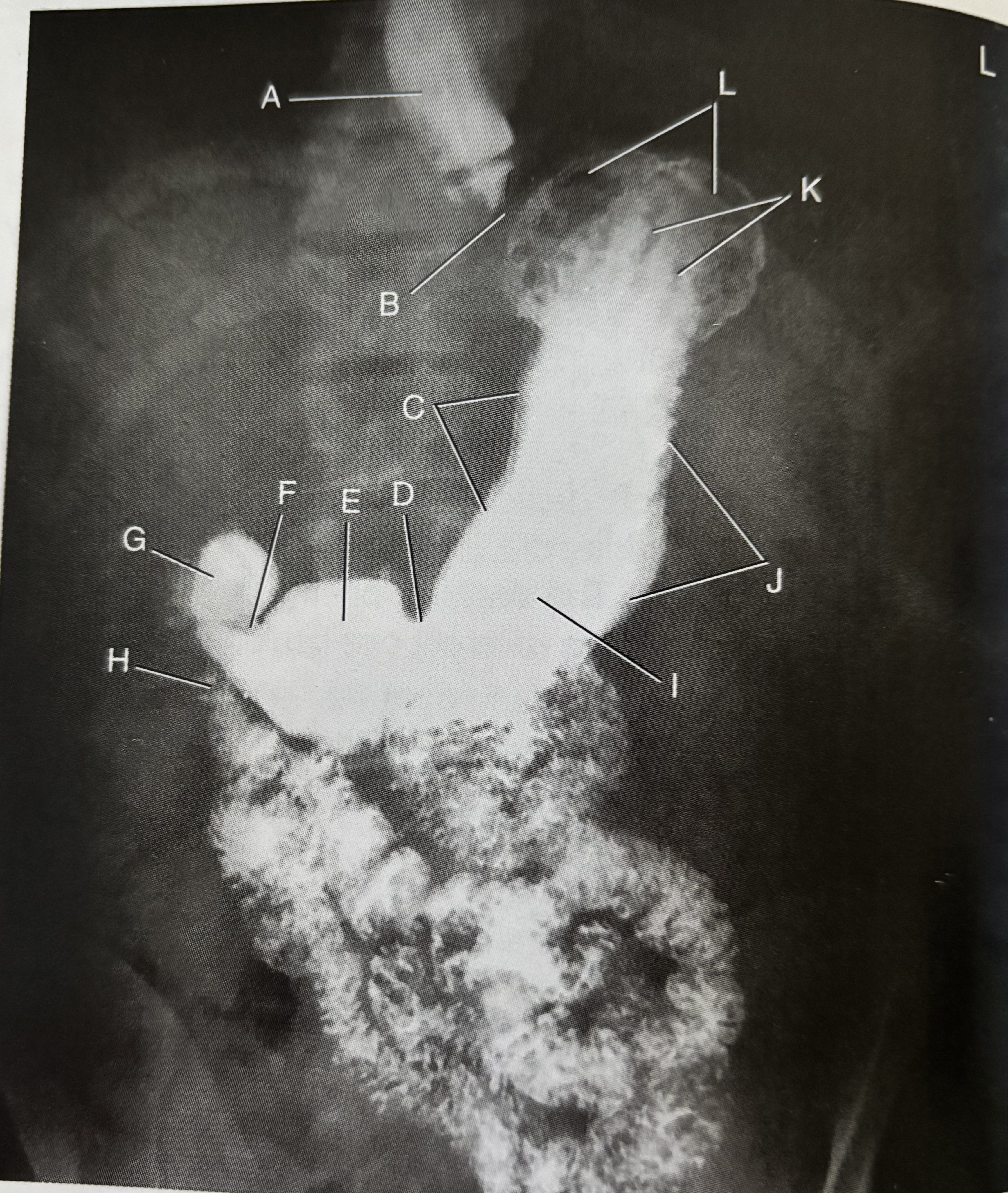 <p>What is E pointing to?</p>