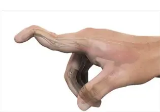 <p>Mallet Finger</p>