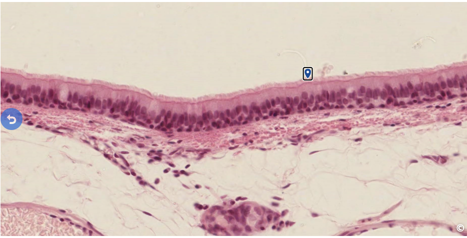 <p>identify the surface specialization</p>