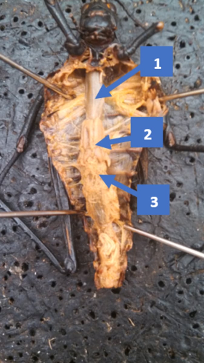 <p>excretory, used to eliminate waste, osmoregulation (3)</p>