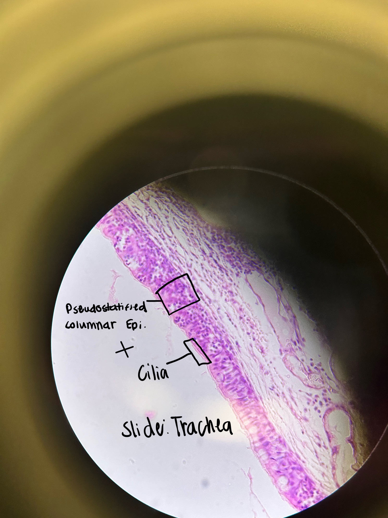 <p>Where would you find Pseudostratified Ciliated Columnar Epi. and what does it do?</p>