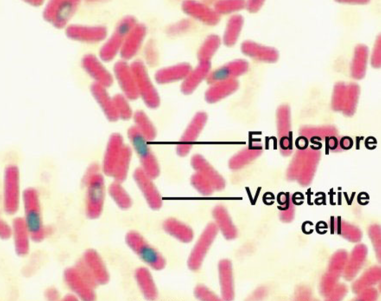 What kind of staining is this?