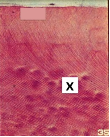 <p>Identify the tissue marked with an “X”</p>