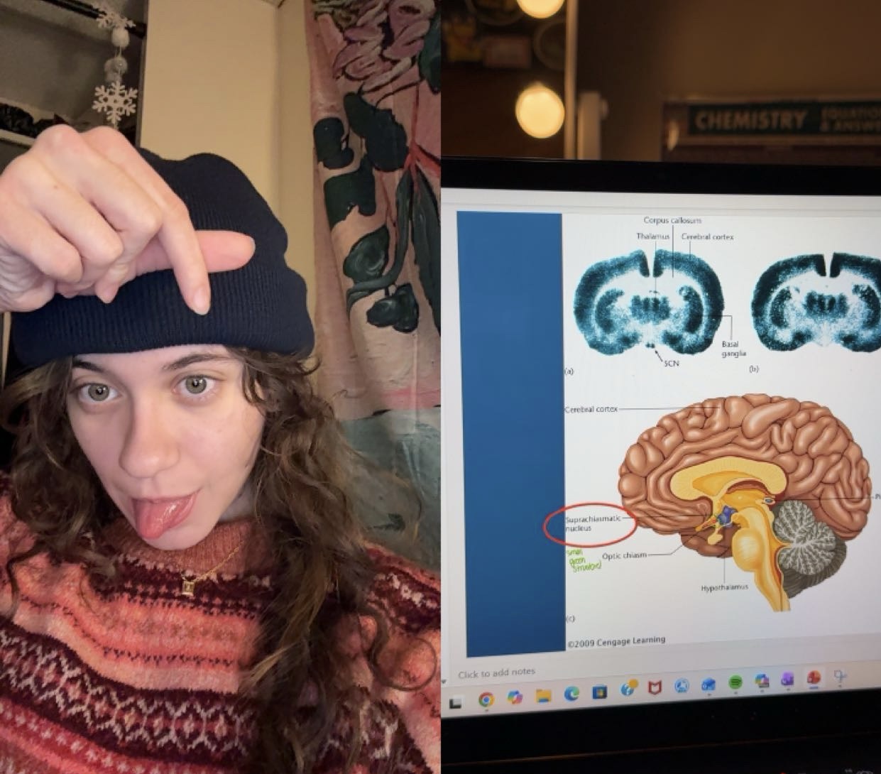 <p>dorsal to optic chains</p>