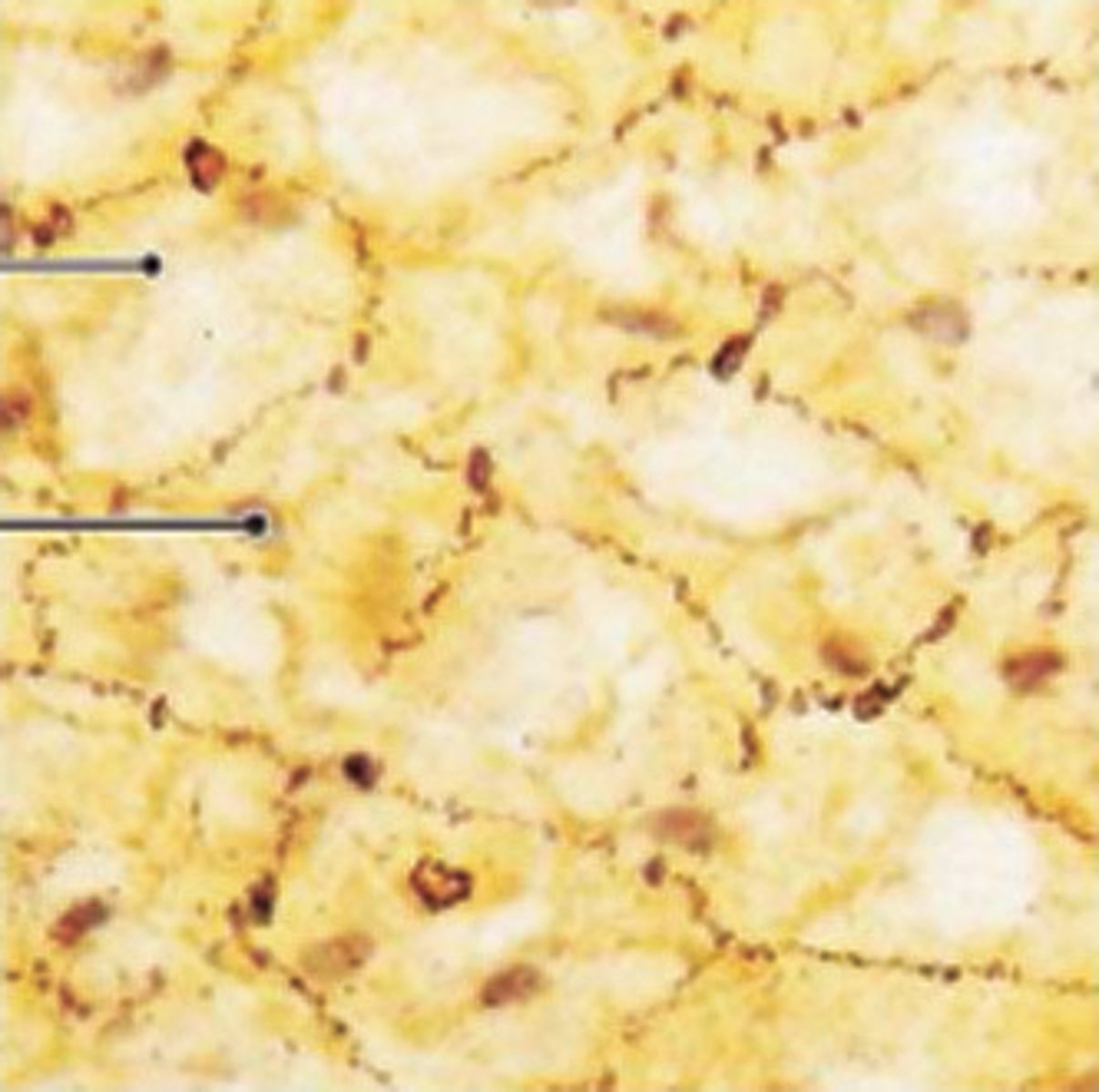 <p>single layer of flattened cells, function is diffusion and filtration, location is air sacs of lungs, walls of capillaries</p>