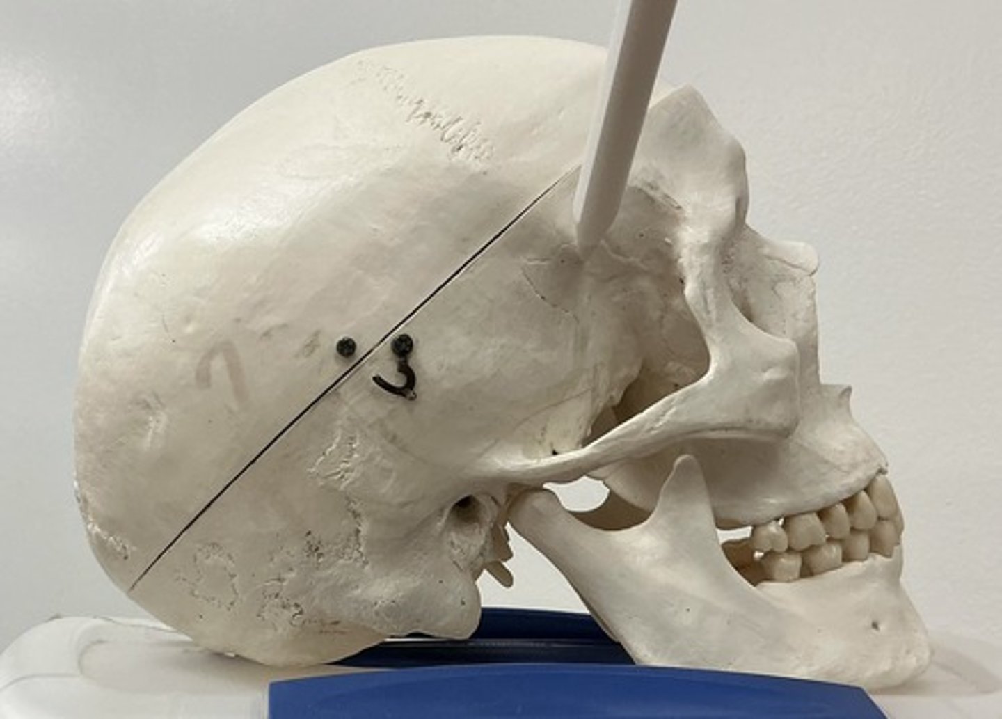 <p>What bone is this?</p>