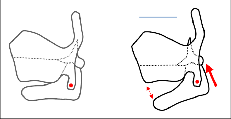 <p>movement: rotation</p><ul><li><p>thyroid cartilage moves <strong>forward and downward</strong></p></li><li><p>cricoid cartilage moves <strong>backward and upward</strong></p></li></ul><p></p><p>result: elongates the vocal folds which increases the pitch of the voice</p>