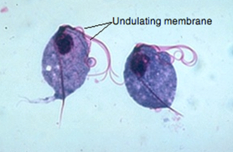 <p>Fluid from stomach of aborted fetus or uterine discharge</p>
