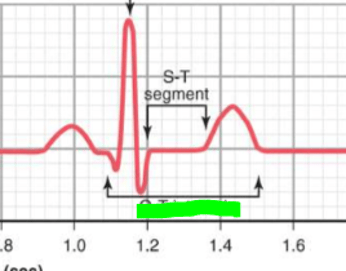 <p>What does the interval in green represent?</p>