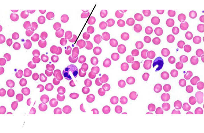 <p>What Type of connective Tissue is this?</p>