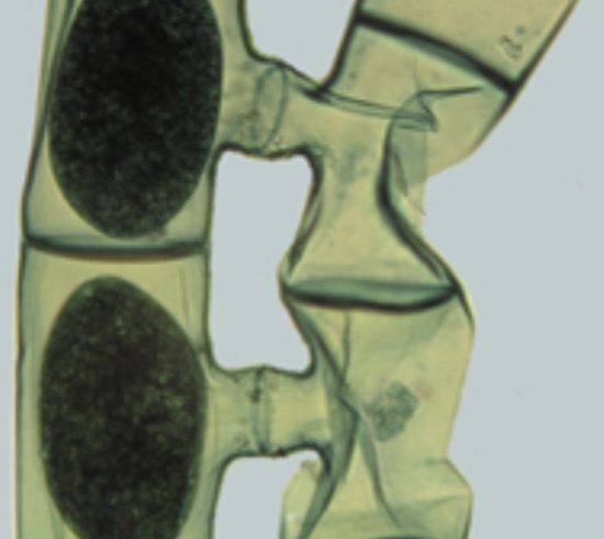 <p>Identify the charophyte</p>
