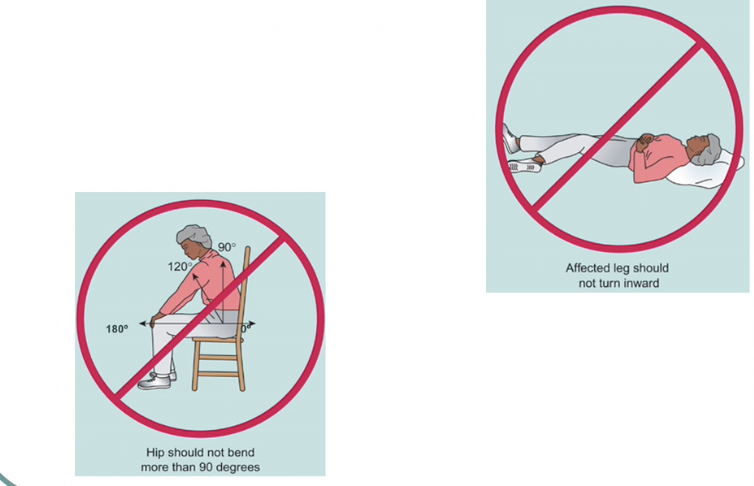 <p>PROPER POSITIONING: maintain abduction for some replacements </p><ul><li><p>put a wedge between 2 legs (abductor pillow) because when you keep legs together/crossed legs → increases chance of hip dislocation </p></li></ul><p>sometimes instruction to not flex hip &gt; 90 degrees (hip higher than knee)</p><ul><li><p>when you try to pick up something from the floor or tying your shoes </p></li></ul><p>no internal or external rotation of the affected leg/hip </p><ul><li><p>knee pointing up straights </p></li></ul><p>depends on the type of procedure; more common for posterior approach procedures </p>
