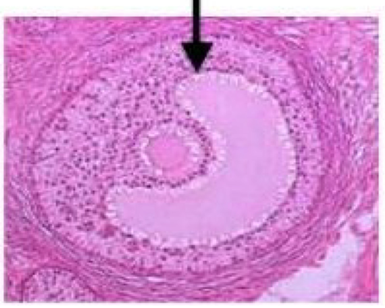 <p>Secondary follicle </p>