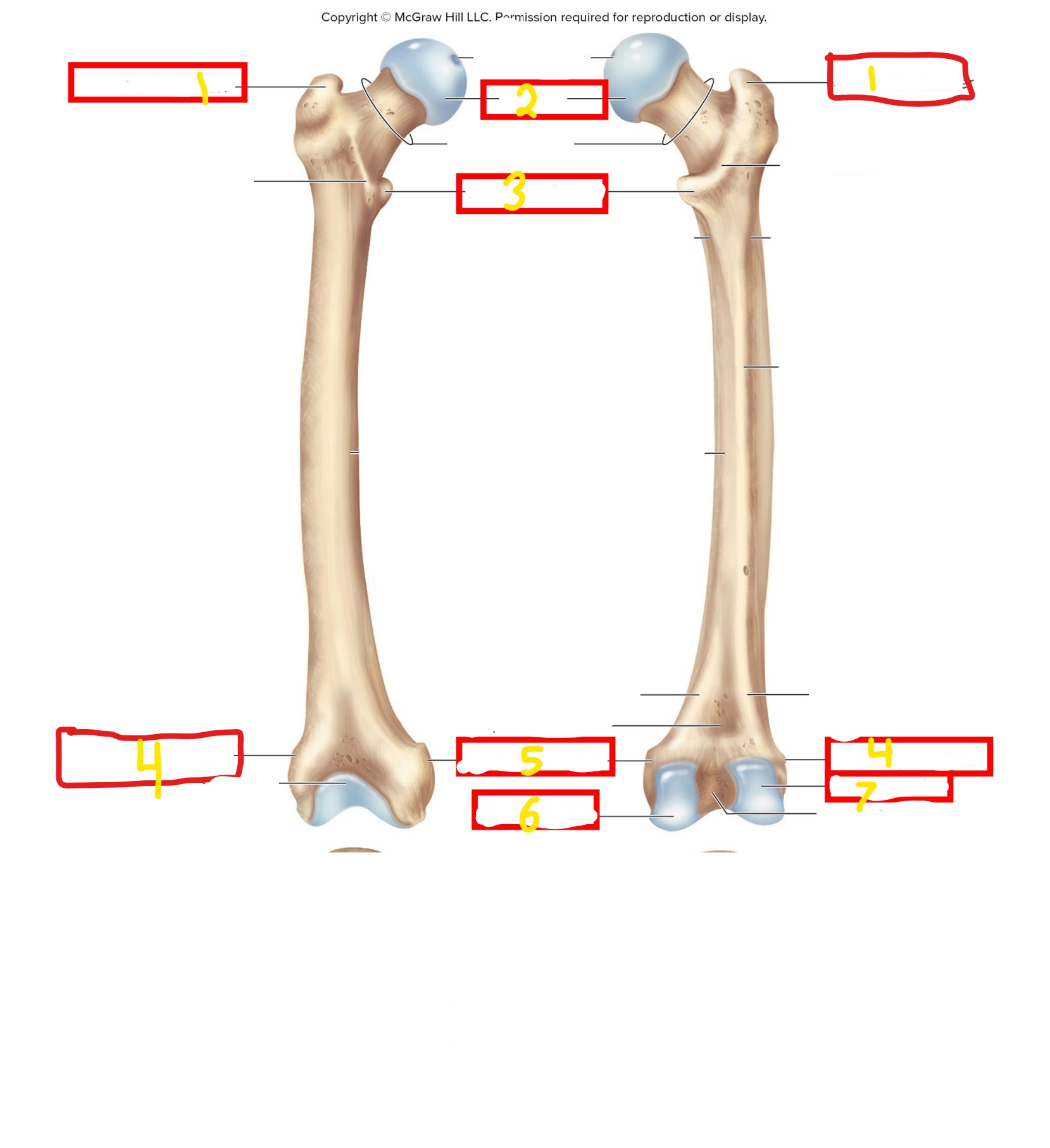 <p>what bone is this</p>