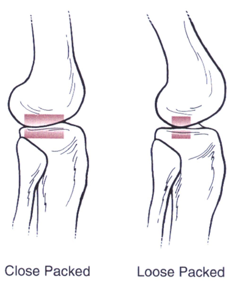 <p>- Position of least tension of capsule and periarticular tissue</p><p>- Allows for maximal joint volume.</p><p>- Greatest availability for glide</p>