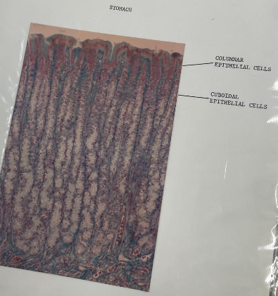 <p>stomach</p>