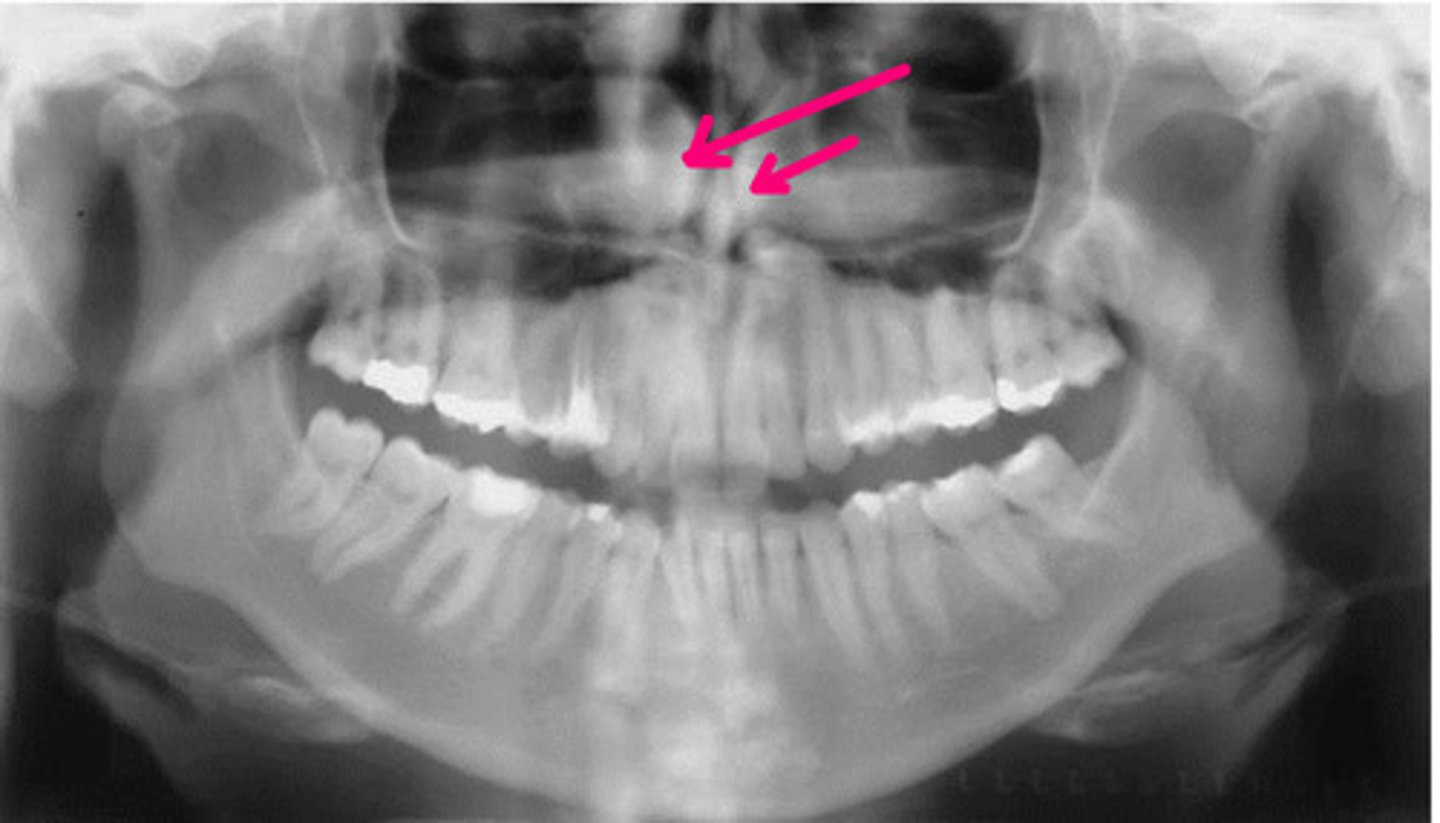 <p>Identify the structure.</p>