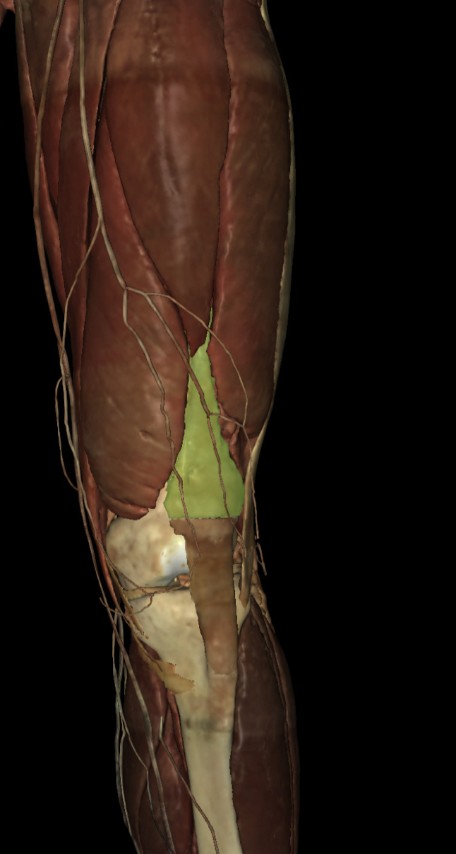 <p>Identify the Structure</p>